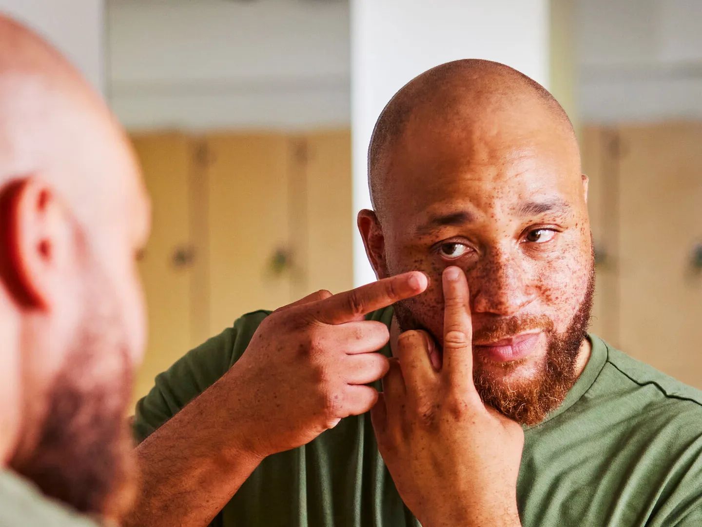 De uitgebreide contactlenzengids